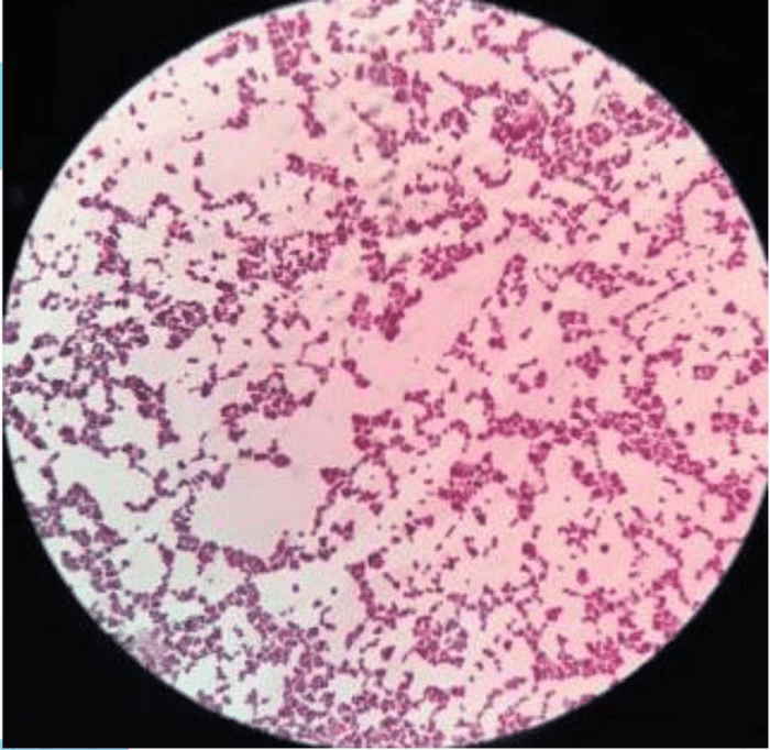 Staphylococcus aureus under microscope 100x