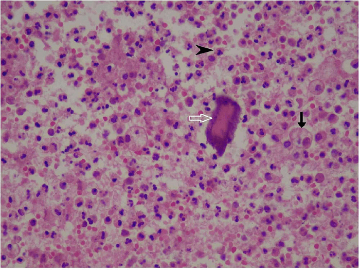 Staphylococcus aureus under microscope 100x