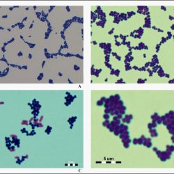 Staphylococcus aureus gram cocci clusters microbiology pseudomonas aeruginosa noel choose board