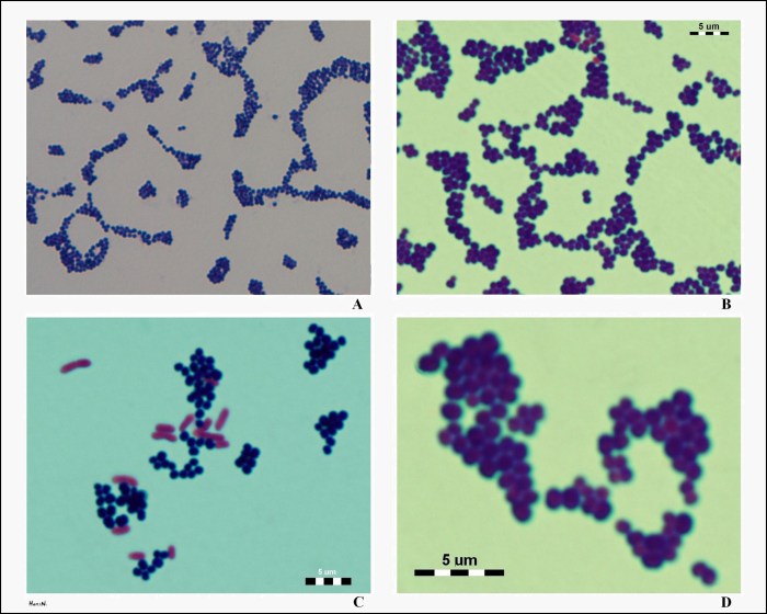 Staphylococcus aureus gram cocci clusters microbiology pseudomonas aeruginosa noel choose board