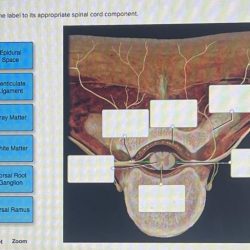 Match the label to its appropriate spinal cord component.