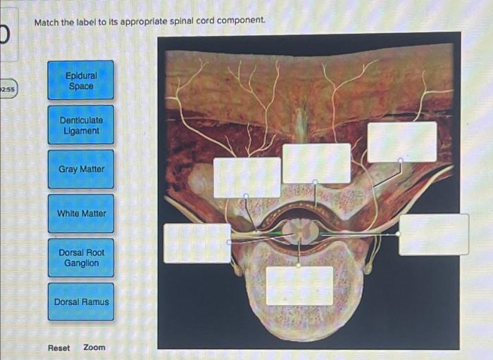 Match the label to its appropriate spinal cord component.