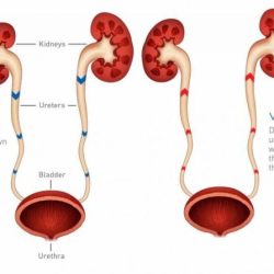 The combining form for the sac that stores urine is